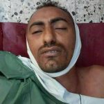 التفاصيل الكاملة للمعارك المستعرة منذ أسبوعين شرقي مدينة تعز