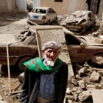 20 صورة تبين لك أن اليمن يعيش أكبر مأساة إنسانية في العالم التحالف