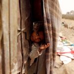 20 صورة تبين لك أن اليمن يعيش أكبر مأساة إنسانية في العالم التحالف