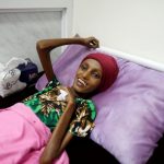 20 صورة تبين لك أن اليمن يعيش أكبر مأساة إنسانية في العالم التحالف