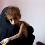 20 صورة تبين لك أن اليمن يعيش أكبر مأساة إنسانية في العالم التحالف