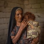 20 صورة تبين لك أن اليمن يعيش أكبر مأساة إنسانية في العالم التحالف