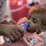20 صورة تبين لك أن اليمن يعيش أكبر مأساة إنسانية في العالم التحالف