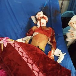 (بالصور) تفاصيل أولية عن جريمة إبادة أسرة كاملة في العاصمة صنعاء بقصف طيران التحالف استهداف أسرة كاملة