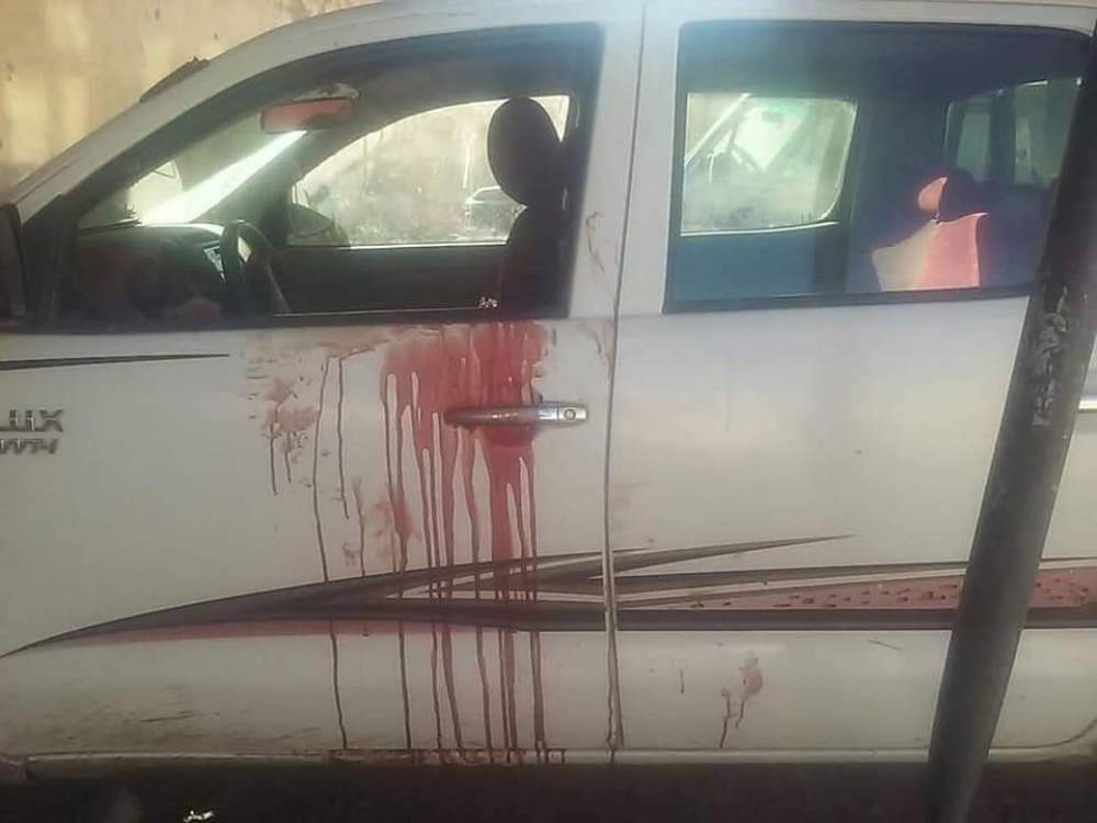 بسبب زواجه من أخرى.. زوجة تقتل زوجها في الضالع (صور) الخبر اليمني
