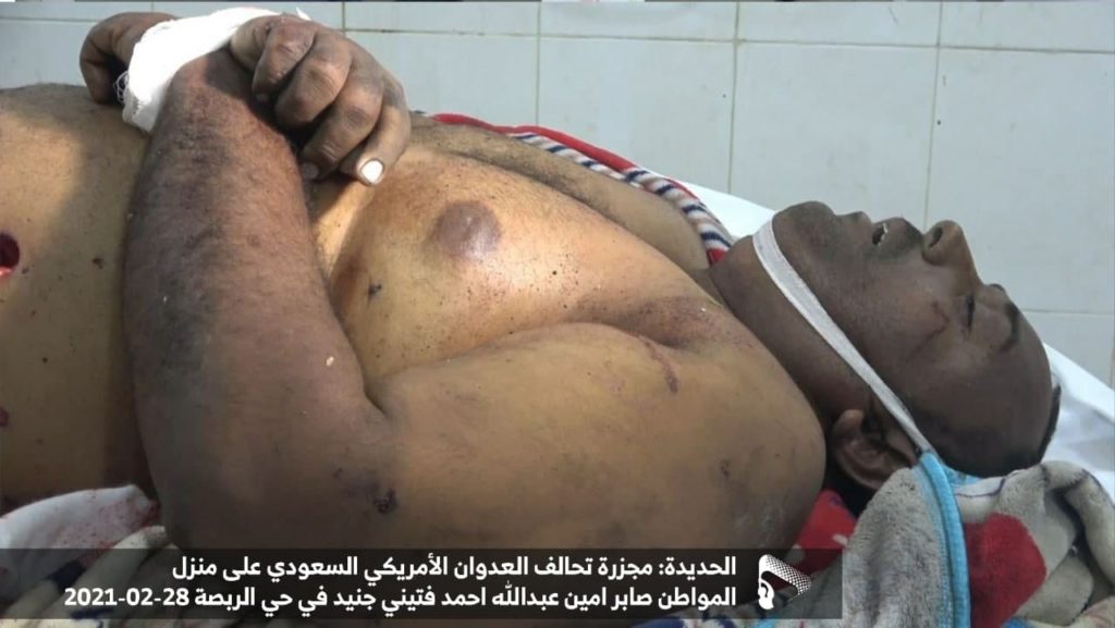الحديدة| جريمة التحالف الأخيرة تذكر اليمنيين بمجازره في المحافظة (صور) اتفاق السويد