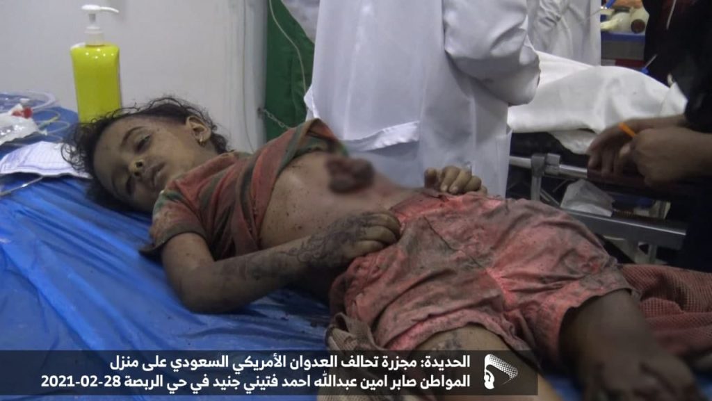 الحديدة| جريمة التحالف الأخيرة تذكر اليمنيين بمجازره في المحافظة (صور) اتفاق السويد