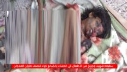 مقتل طفل وإصابة آخر إثر غارة للتحالف على الضالع - صور مؤثّرة 4 مقتل طفل وإصابة آخر إثر غارة للتحالف على الضالع - صور مؤثّرة أخبار اليمن