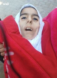 الصورة لـ "إلهام جحا" فتاة فلسطينية ماتت جوعاً في غزّة أخبار اليمن