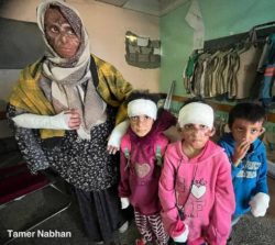 صورة مؤثرة لعائلة فلسطينية أحرق العدو الإسرائيلي وجوه جميع أفرادها أخبار اليمن