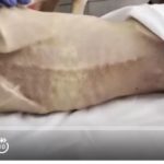 هذا الطفل اسمه "محمد" وقد مات جوعاً في غزّة.. صور تقشعر لها الأبدان أخبار اليمن